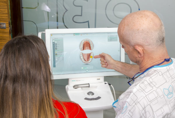 sistema implantes dentales